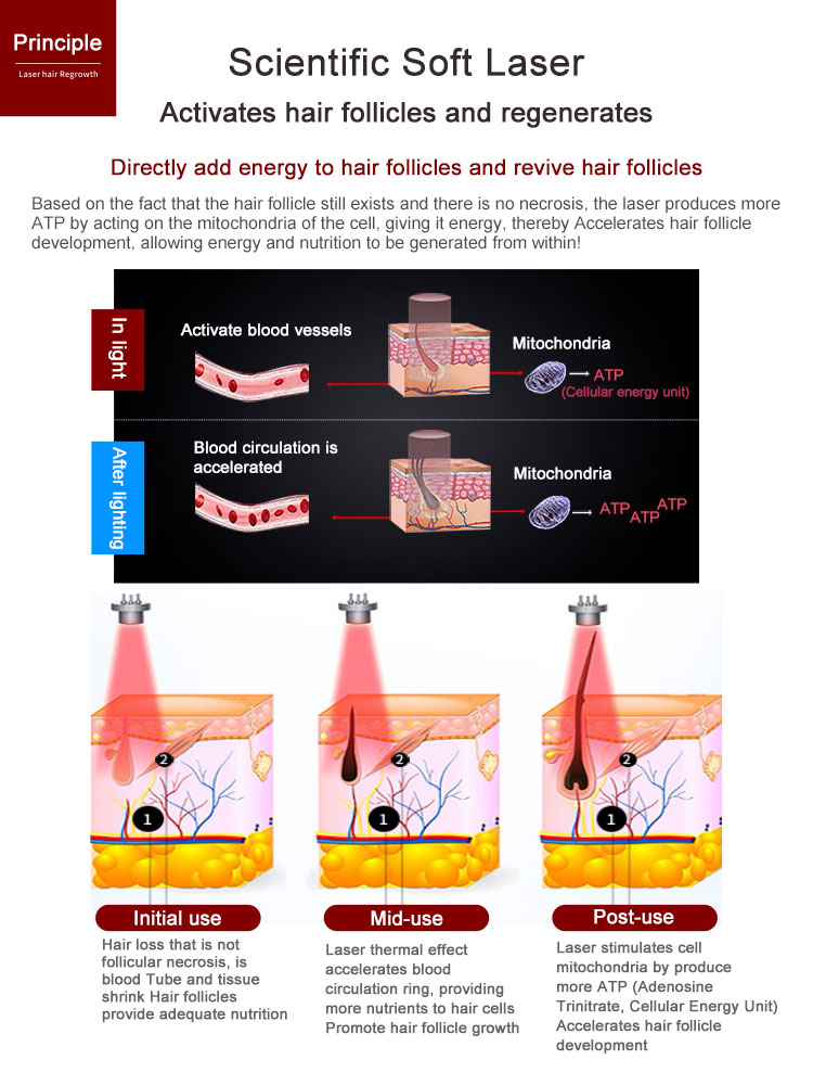 anti hair loss machine